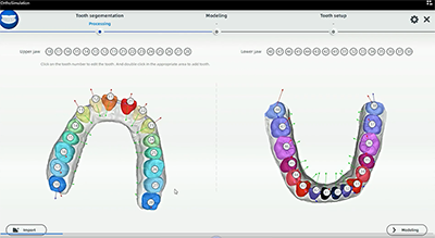 XL013 Dental Aoralscan 3